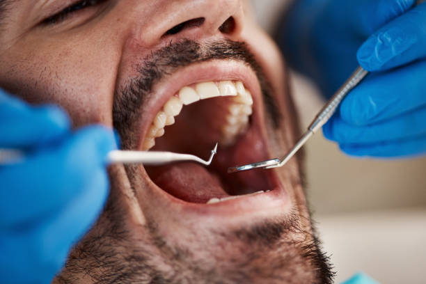 Best Emergency Broken Tooth Repair in Hutto, TX